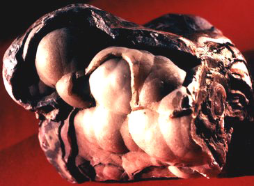 Chalcedony